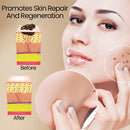 Scar Remove™ Removedor de Cicatrizes e Marcas de Expressão