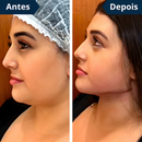 FaceLift™ Redutor de Rugas e Papada - Tenha um rosto LINDO novamente sem Papadas + Creme Exclusivo de Brinde